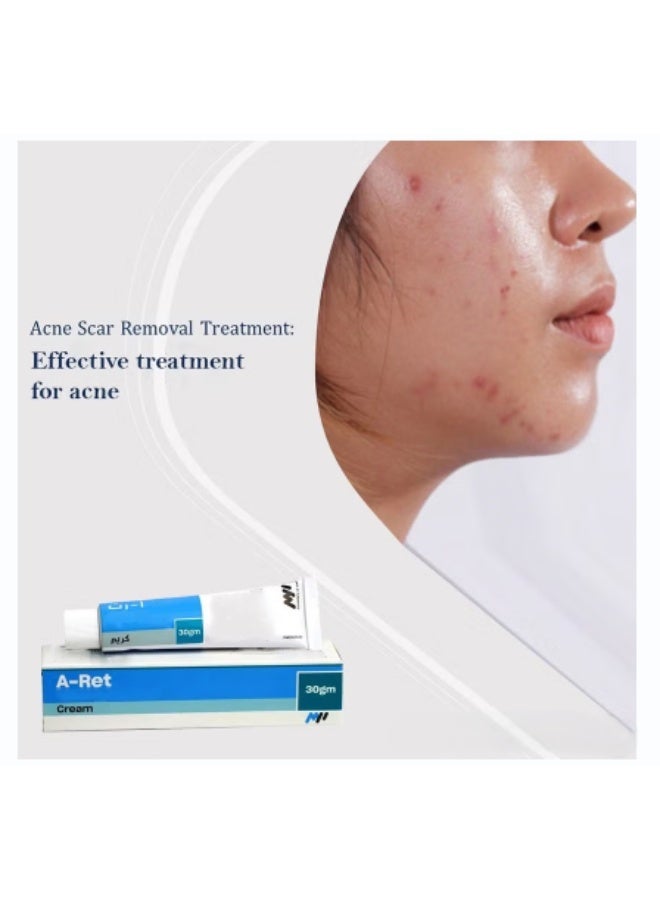 Medpharma A-Ret Cream 30g – For Acne Control, Smooth Texture and Clearer Skin - Image 4